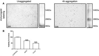 Changes in PGC‐1α/SIRT1 Signaling Impact on Mitochondrial Homeostasis in Amyloid-Beta Peptide Toxicity Model